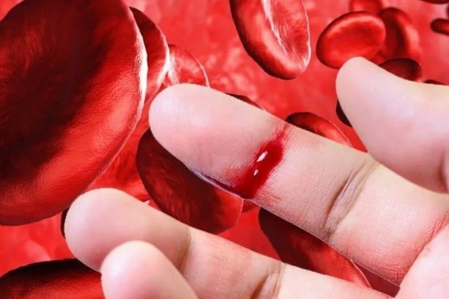 Что значит когда снится кровь